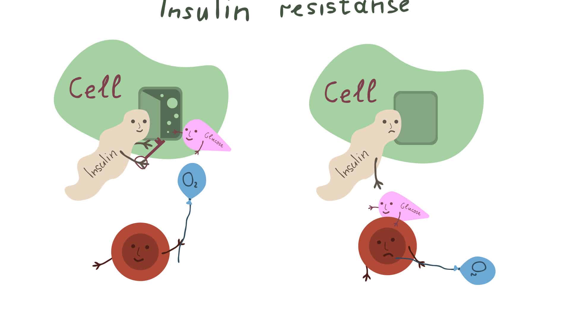 Die Grafik zeigt, wie die Zelle bei einer Insulinresistenz nicht mehr auf das wichtige Hormon reagiert. Die Zelle bleibt öffnet sich nicht mehr für die lebenswichtige Glucose und der Zucker bleibt im Blut.